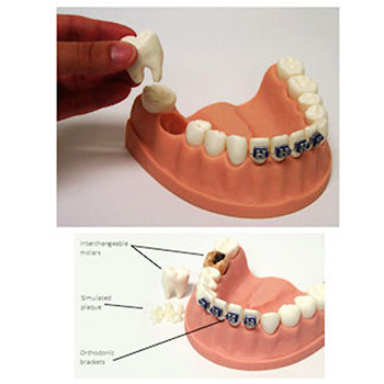 치아관리 모형(79229)