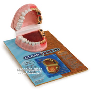 치아 비교모형(79650)